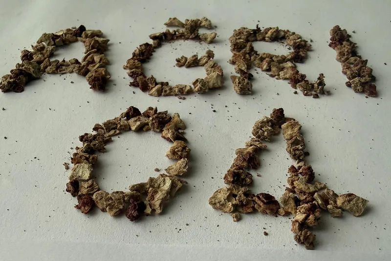 Ağrı'da gerçekleştirilen ameliyatta 295 taş başarıyla çıkarıldı